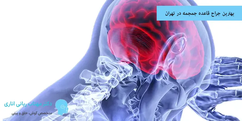 بهترین جراح قاعده جمجمه در تهران