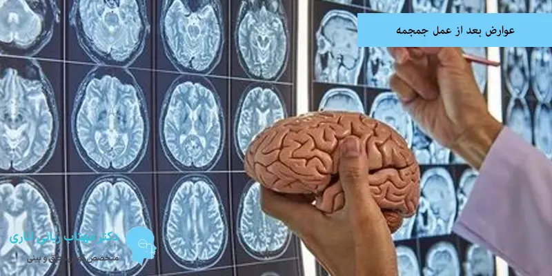 عوارض بعد از عمل جمجمه