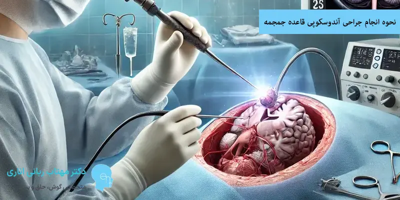 نحوه انجام جراحی آندوسکوپی قاعده جمجمه