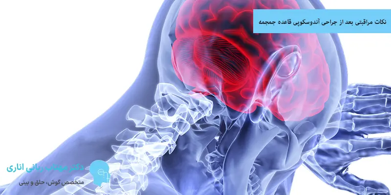 نکات مراقبتی بعد از جراحی آندوسکوپی قاعده جمجمه