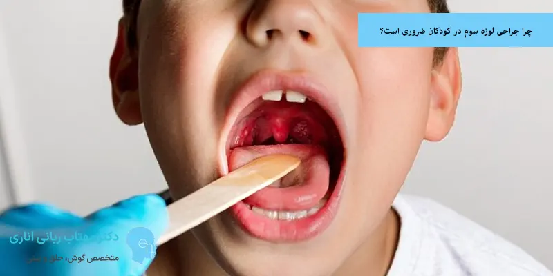 چرا جراحی لوزه سوم در کودکان ضروری است؟