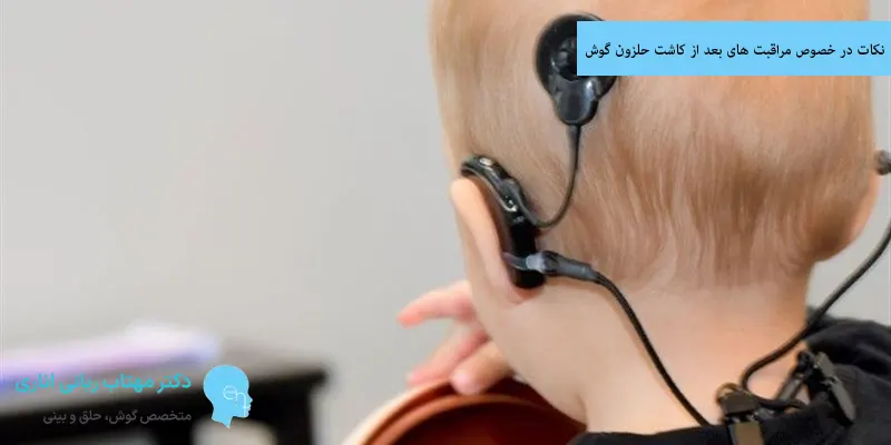 نکات در خصوص مراقبت های بعد از کاشت حلزون گوش