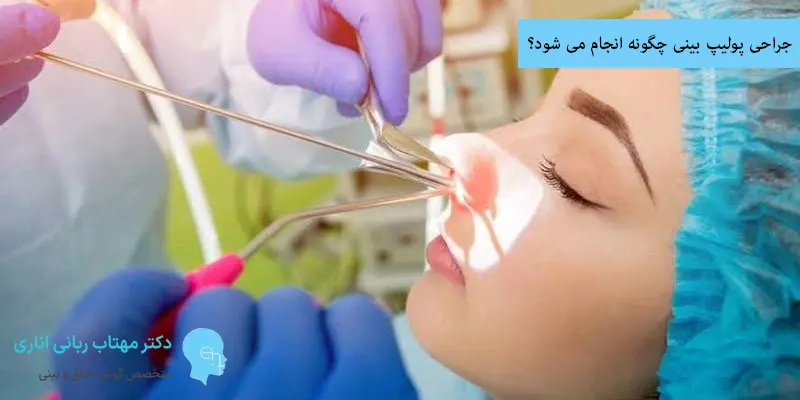 جراحی پولیپ بینی چگونه انجام می شود؟
