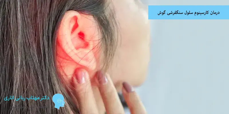 درمان کارسینوم سلول سنگفرشی گوش