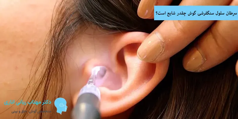 سرطان سلول سنگفرشی گوش چقدر شایع است؟