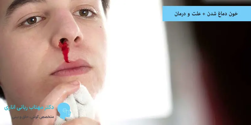 خون دماغ شدن + علت و درمان