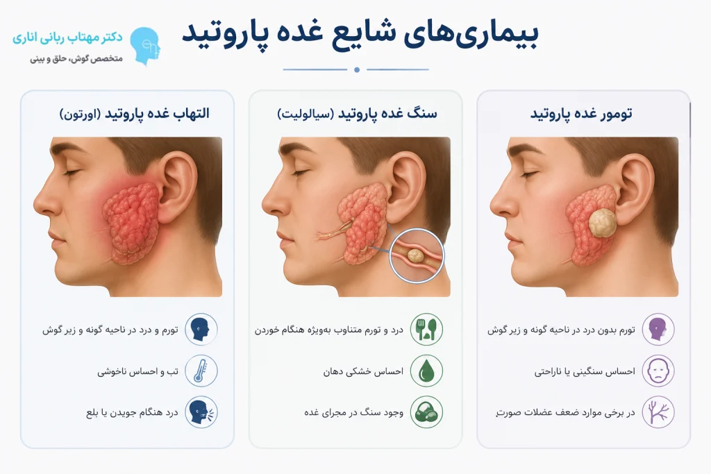 بیماری های شایع غده پاروتید