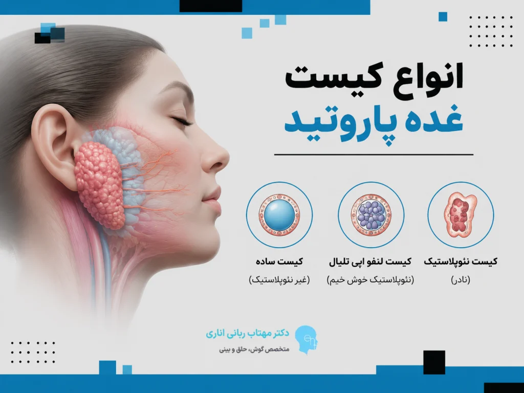 انواع کیست غده پاروتید