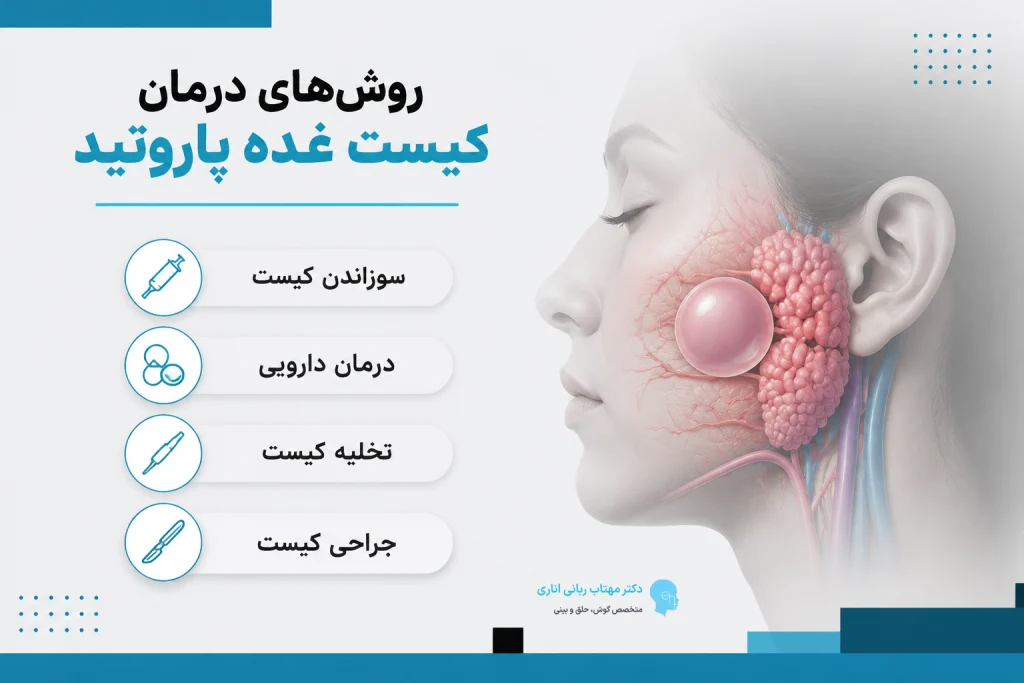 درمان کیست پاروتید