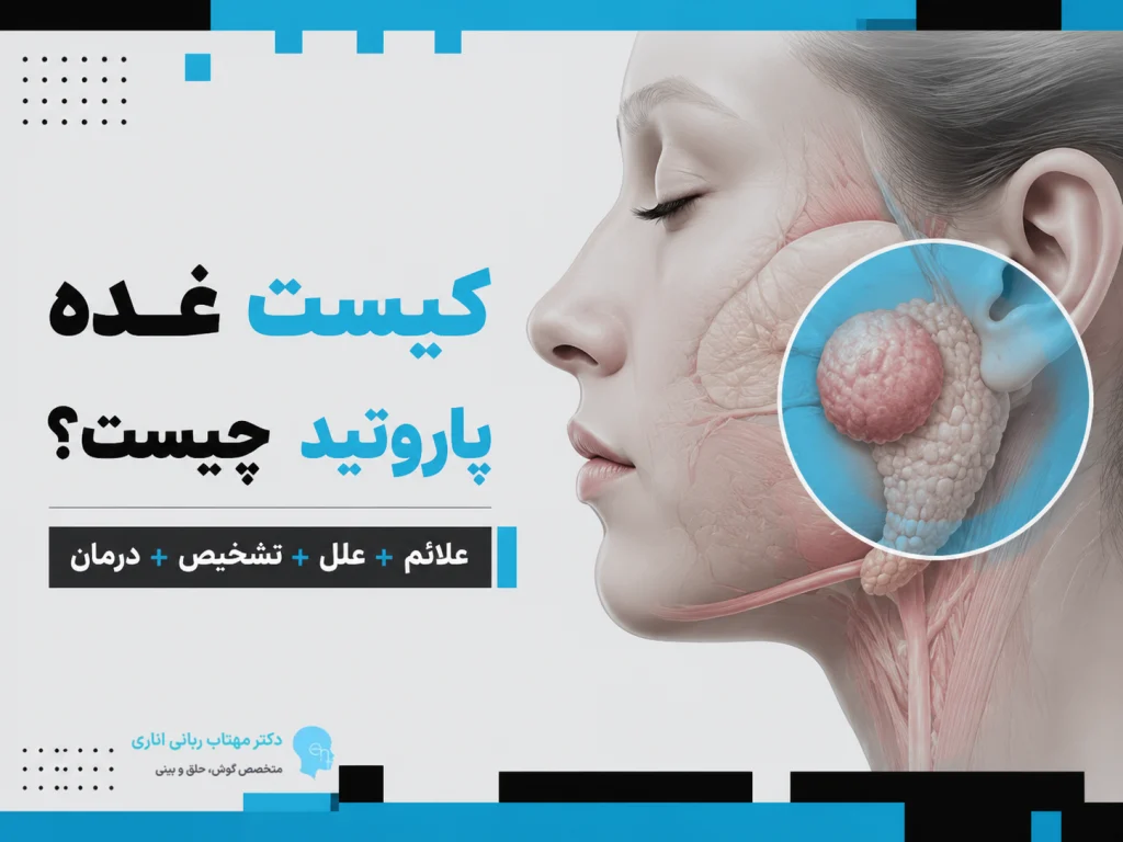 کیست غده پاروتید؛ علائم، علل، تشخیص، درمان